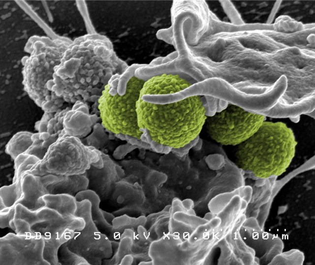 Hospital-Associated Methicillin-resistant Staphylococcus aureus (MRSA) Bacteria. Interaction of MRSA (green bacteria) with a human white cell. Credit: NIAID